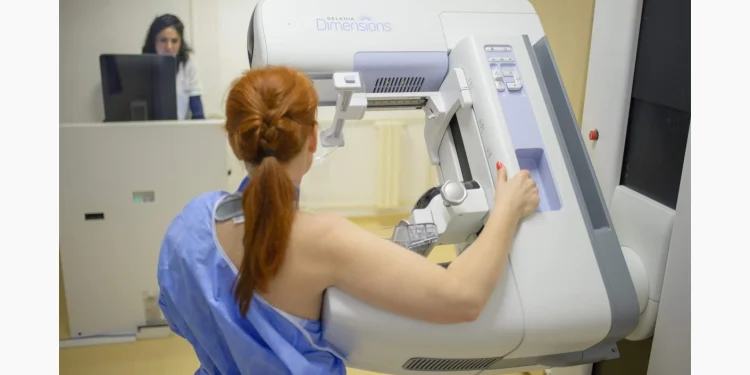 Mamografii gratuite pentru peste 600 de femei din Bistrița-Năsăud